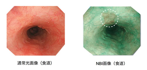 精密な診断を目指して